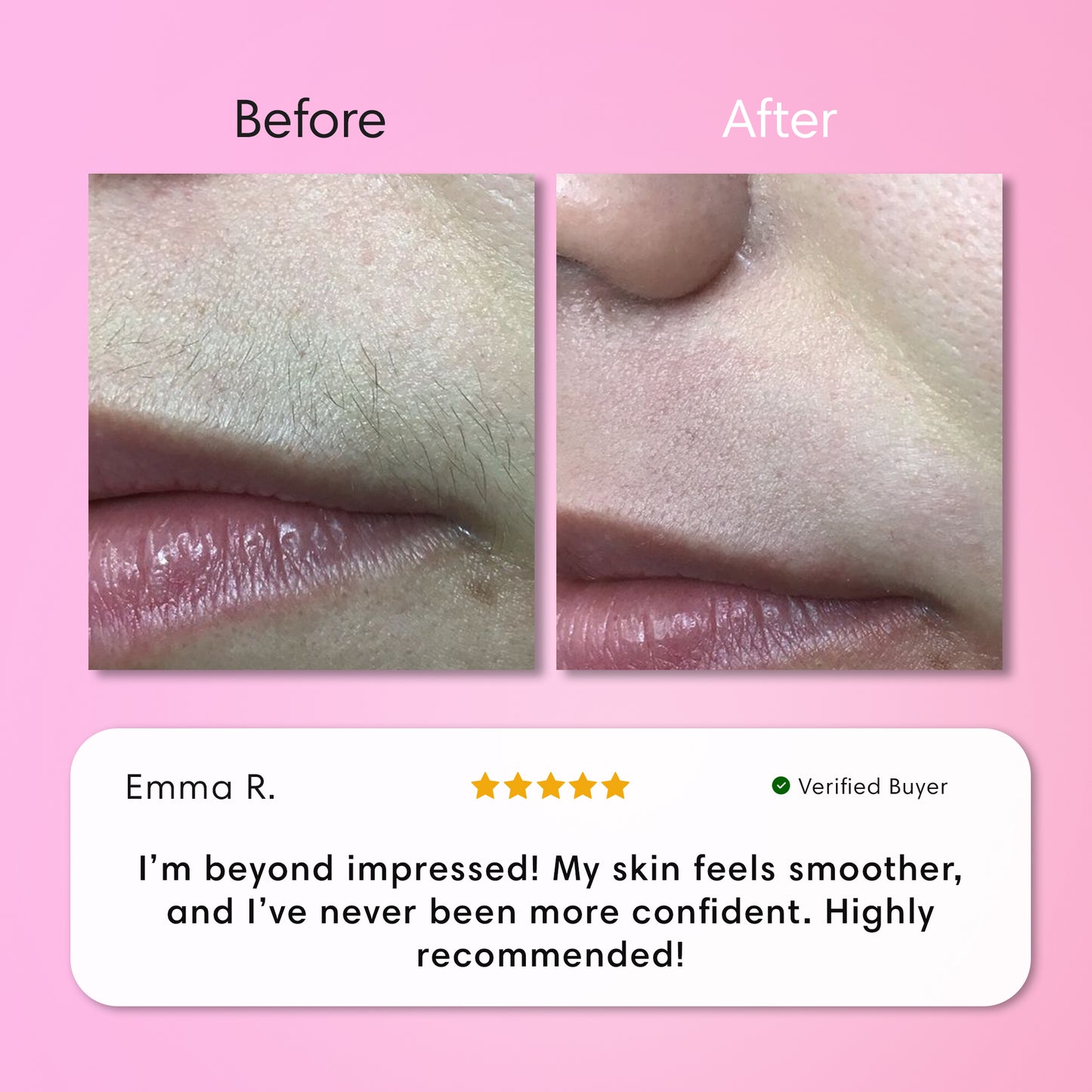 Instant Hair Removal Kit