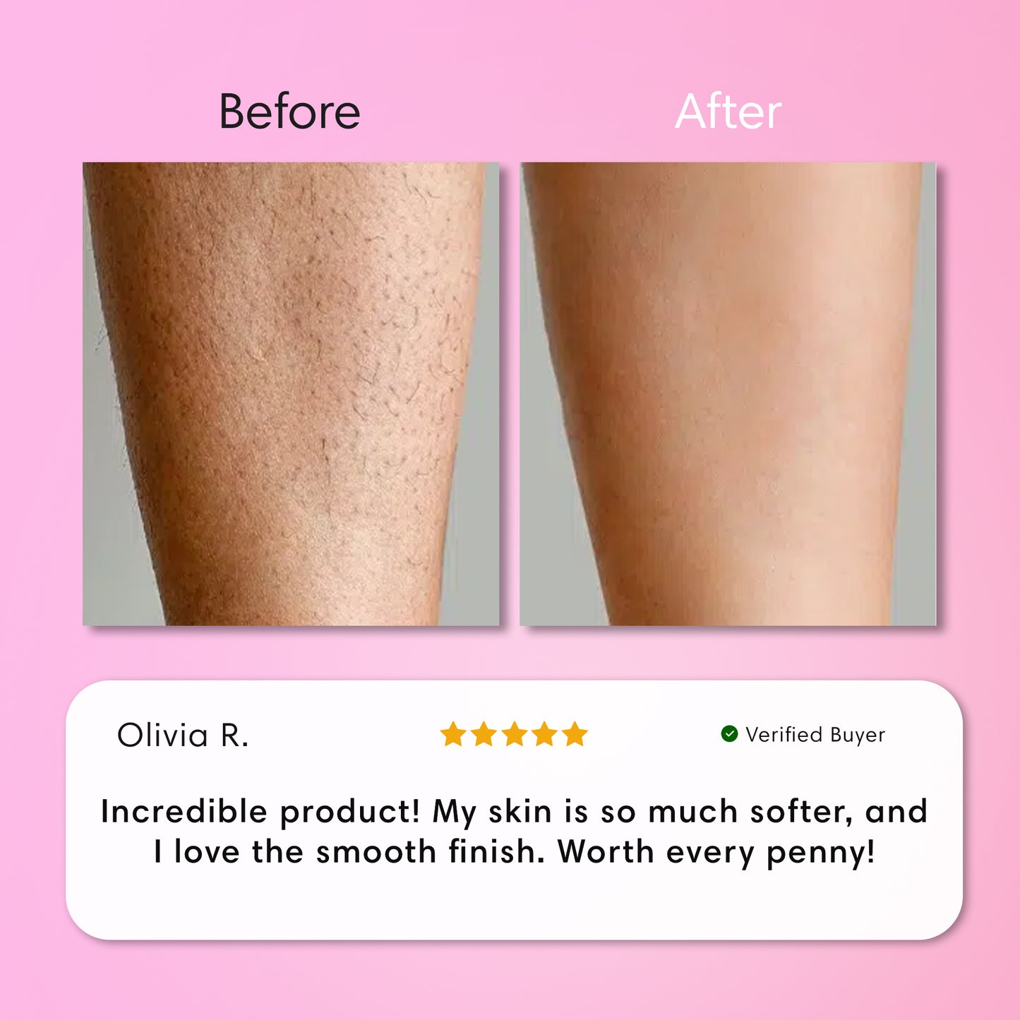 Body Hair Removal Kit