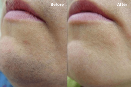 Customer before and after result 1