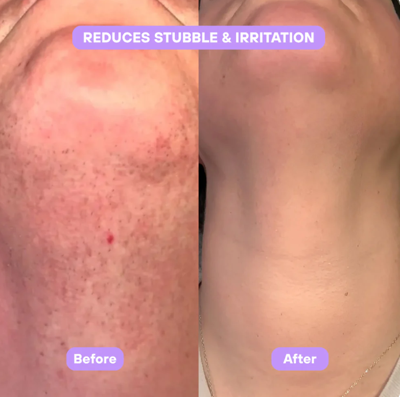 Aurlux™ Cyperus Rotundus Skin Serum