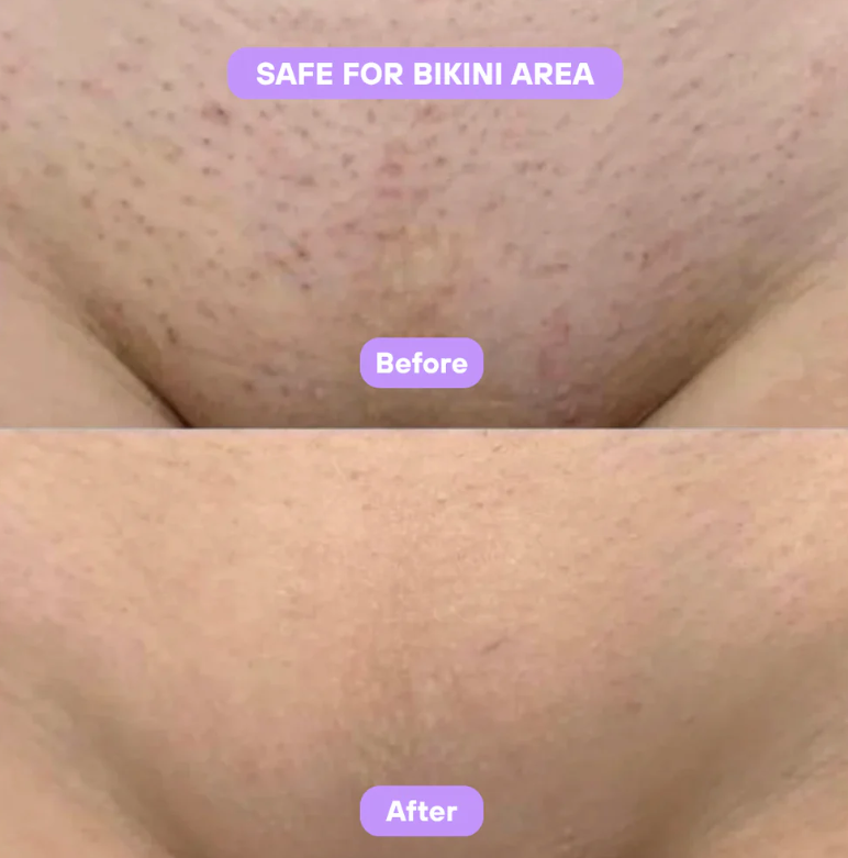 Aurlux™ Cyperus Rotundus Skin Serum