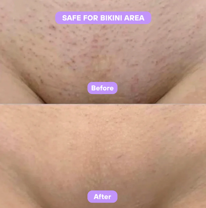 Aurlux™ Cyperus Rotundus Skin Serum