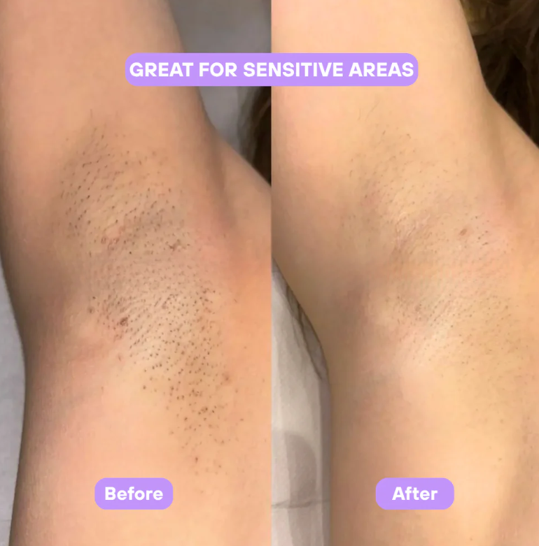 Aurlux™ Cyperus Rotundus Skin Serum