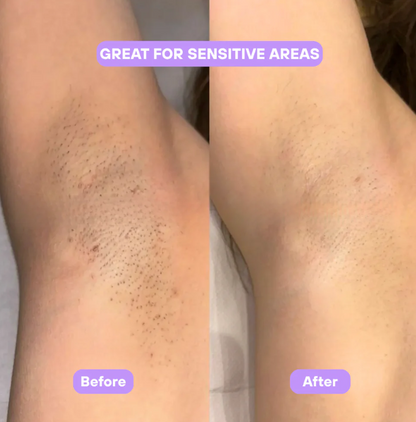 Aurlux™ Cyperus Rotundus Skin Serum