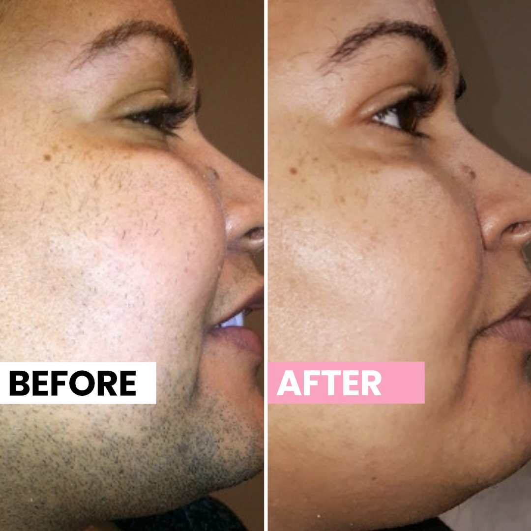 Before and after