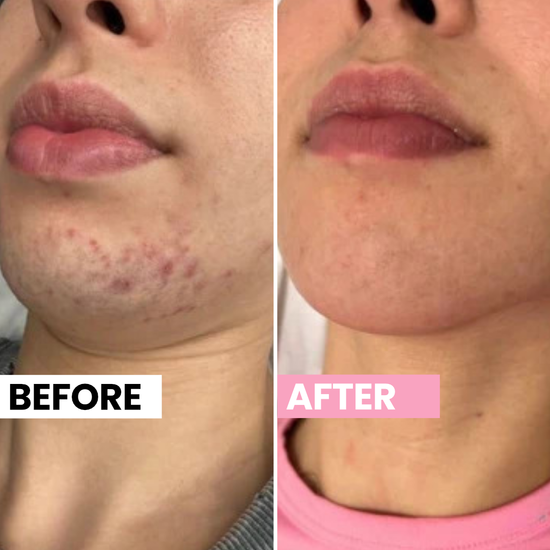 Customer before and after result 4