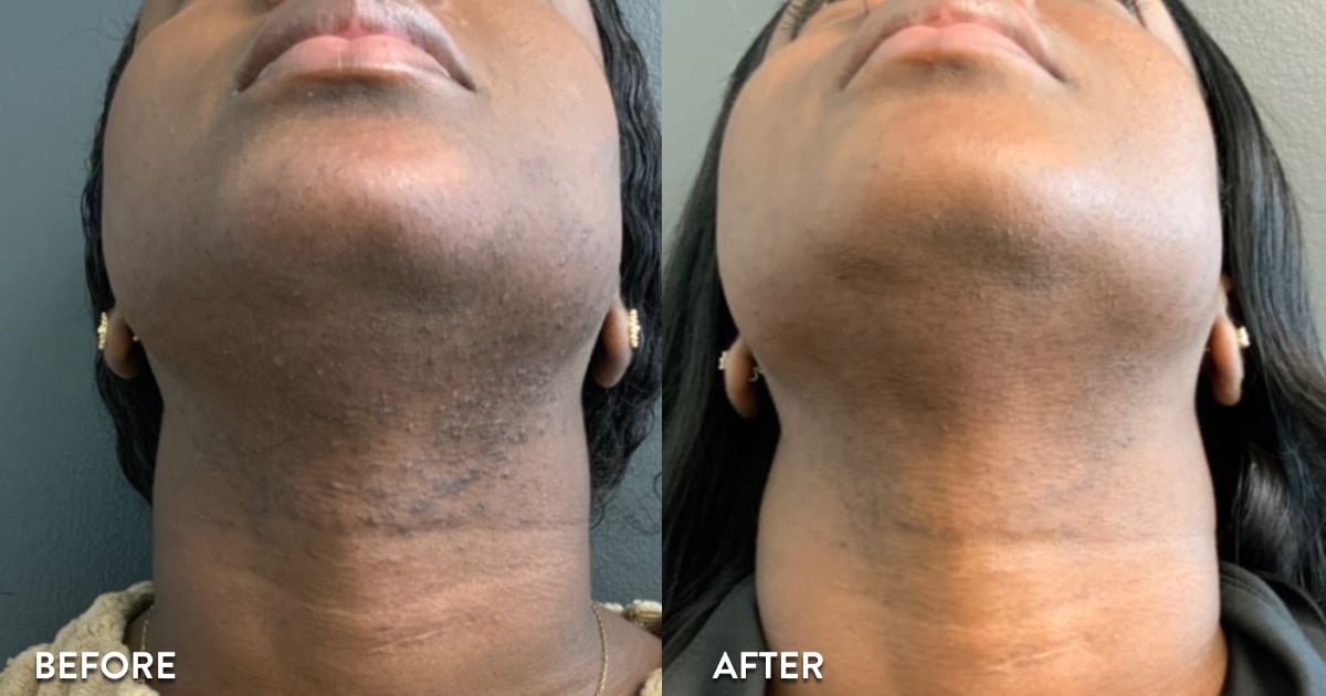 Customer before and after result 2