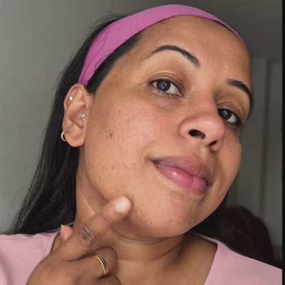 Hair Removal Trilogy Kit